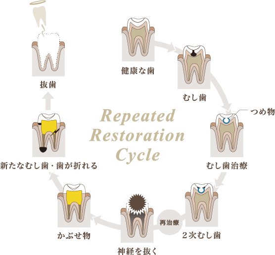 Repeated Restoration Cycle